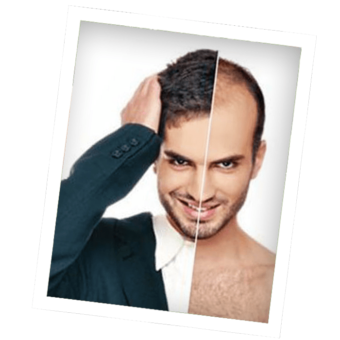 best hair transplant clinic Bangalore, hair transplant Bangalore, hair restoration, hair treatments, hair loss solutions, hair growth clinic, advanced hair care, hair rejuvenation, hair thinning treatment, Sparha hair clinic