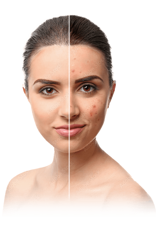 skin treatment, cosmetic services, Sparha Bangalore, anti-aging, skincare, aesthetic clinic, laser treatments, facials