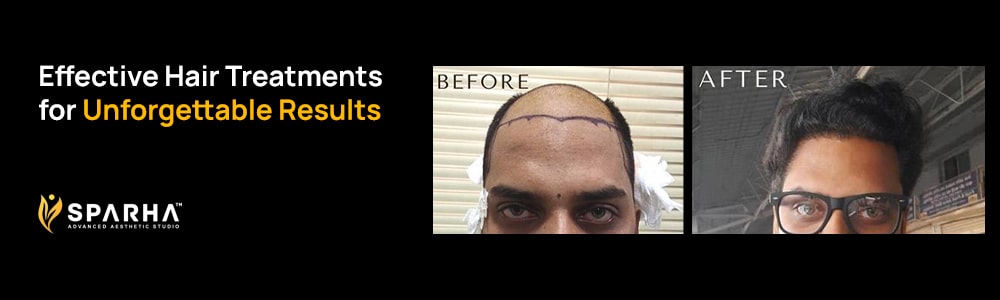 aesthetic clinic Bangalore, skin treatments Bangalore, hair transplant Bangalore, plastic surgery Bangalore, non-surgical aesthetics, anti-aging treatments, laser hair reduction, body contouring Bangalore, Sparha Advanced Aesthetic, Arti Singh aesthetics