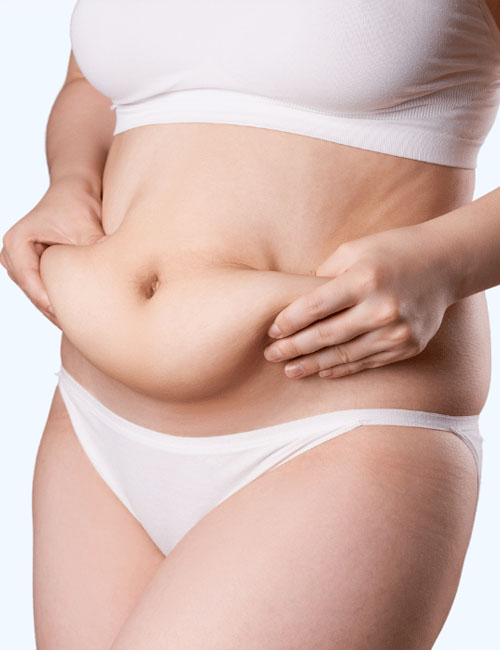 weight loss Bangalore, best weight loss treatment, weight management, fat reduction, body contouring, weight loss clinic